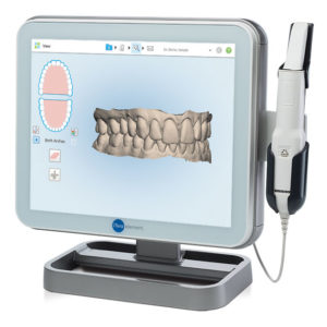 ITero Scanner for Braces & Orthodontists